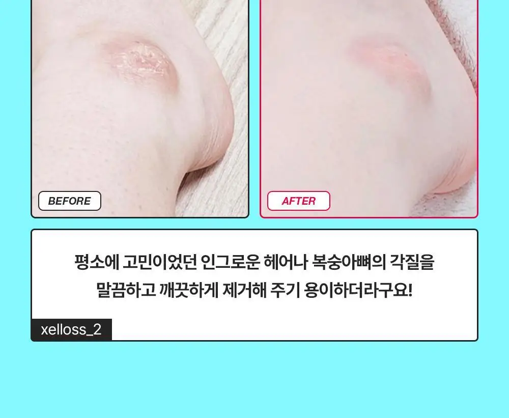 [NEW/각질제거] 런드리유 소프트 바디 레드 글러브 클린 1매입 / 5매입 상세페이지 12